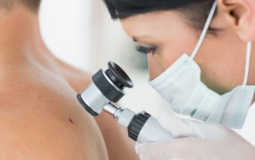 De ce este importantă diagnosticarea precoce a cancerului de piele?