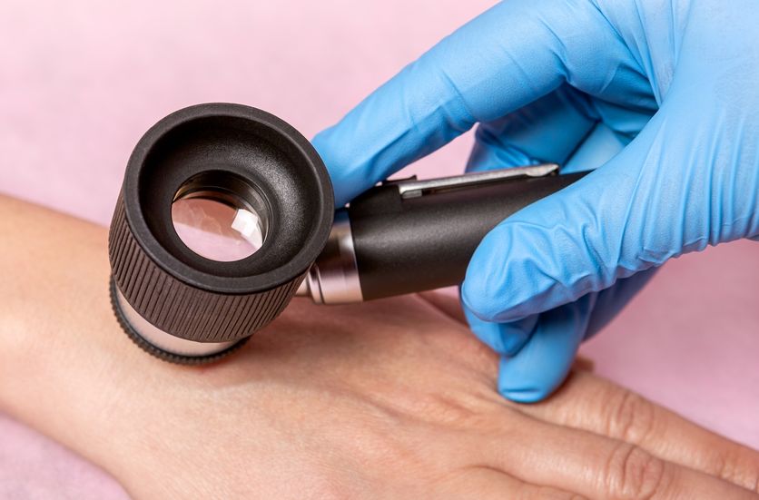 Programare pentru dermatoscopie pentru diagnosticarea afecțiunilor pielii, Neuromed Sf. Luca