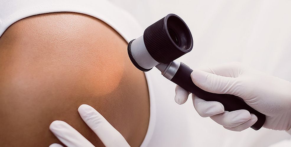 Înscrieți-vă pentru dermatoscopie - aveți grijă de pielea dumneavoastră și de sănătatea generală.